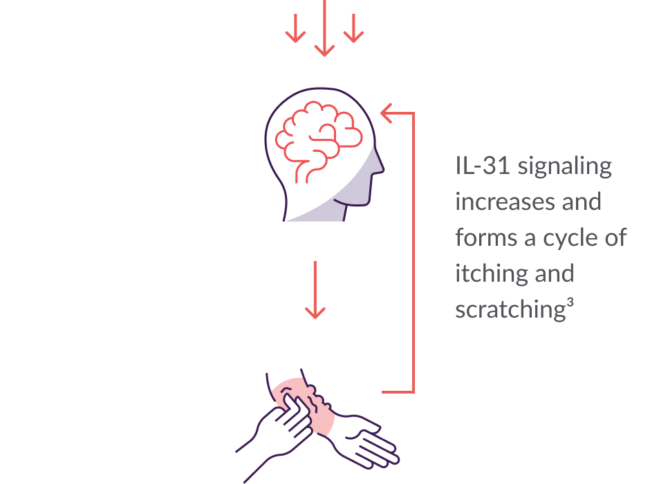 Prurigo Nodularis (PN) Itch Signal Pathway