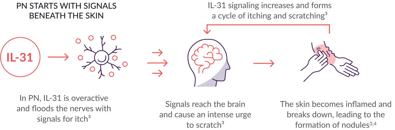 Prurigo Nodularis (PN) Itch Signal Pathway